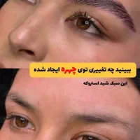 تخفیف ویژه فیبروزابرو