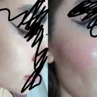 آموزش و خدمات تزیق ژل و تتو صورت و بدن