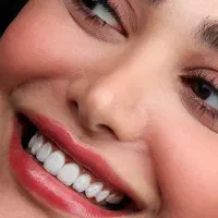 جشنواره  خدمات زیبایی دندان کامپوزیت