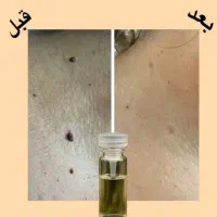 درمان|آرایشی، بهداشتی، درمانی|شهرکرد, |دیوار