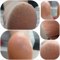 تخفیف ویژه آموزش کاشت ناخن و پدیکور وپارافین تراپی|خدمات آرایشگری و زیبایی|بروجرد, |دیوار