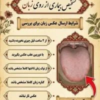 تشخیص  بیماری از طریق زبان مشاوره تلفنی رایگان