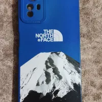 قاب گوشی شیائومی نت ۱۲s