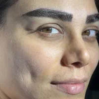 کاشت ابرو طبیعی و دائمی