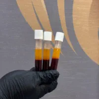 پی ارپی،مزو تراپی مو و صورت|خدمات آرایشگری و زیبایی|خرم‌آباد, |دیوار