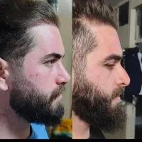 عمل بینی اقتصادی  در تهران با پزشک متخصص
