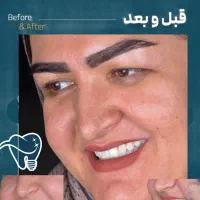 دندانپزشکی/ مرکز ایمپلنت دیجیتال 6800|خدمات آرایشگری و زیبایی|تهران, پاسداران|دیوار