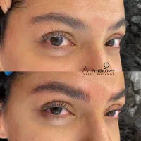 میکروبلیدینگ ابرو