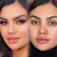 مدل|استخدام درمانی، زیبایی، بهداشتی|کرمان, |دیوار