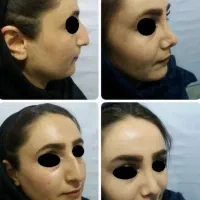جراحی بینی پیکرتراشی برزیلی لیپو پروتز لیفت سینه|خدمات آرایشگری و زیبایی|تهران, تهرانپارس غربی|دیوار