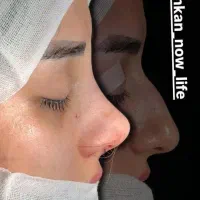 بینی بدون نقص با بهترین جراح متخصص گوش و حلق|خدمات آرایشگری و زیبایی|تهران, دروس|دیوار