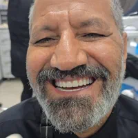 عصب کشی ، کشیدن رایگان ، ترمیم ۲،۵۰۰