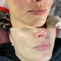 پاکسازی پوست بانوان