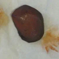 معاوضه مهره خون اصل با انگشتر