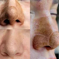 پلاسما جت. لیفت ولمینت ابرو و مژه|خدمات آرایشگری و زیبایی|اصفهان, خواجو|دیوار