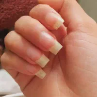 محصولات درمانی با بهترین کیفیت|آرایشی، بهداشتی، درمانی|ارومیه, |دیوار