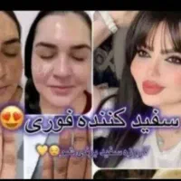 کرم معجزه روشن کننده قوی ضدلک جوش وتیرگی ضمانتی