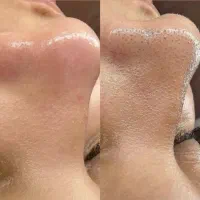 فشیال تخصصی
