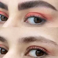 تخفیف میکروبلیدینگ