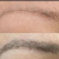 پاک کردن انواع تاتو صورت در یک جلسه|خدمات آرایشگری و زیبایی|نیشابور, دارایی|دیوار