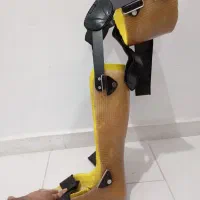 آتل بعد از عمل