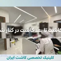 کاشت مو/ فول تراکم/ متد FIT/ بدون نیاز به جراحی|خدمات آرایشگری و زیبایی|تهران, دروس|دیوار