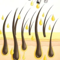 تونیک ضد ریزش و محرک رشد مجدد مو|آرایشی، بهداشتی، درمانی|بابل, |دیوار