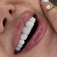 کامپوزیت فقط سرو