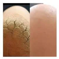 پدیکور و کفسابی پا