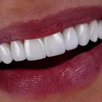 دندانپزشکی بدون پیش پرداخت عصب کشی . کامپوزیت و...|خدمات آرایشگری و زیبایی|قم, عمار یاسر|دیوار