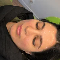 بوتاکس تخصصی، از 990 تومن، مصپورت و دیستون، ونک