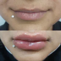 لیفت تخصصی صورت و ابرو فقط امرور با ۴۰ درصد تخفیف|خدمات آرایشگری و زیبایی|شیراز, بعثت|دیوار