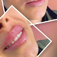 جشنواره زیبایی کلینیک آس|خدمات آرایشگری و زیبایی|تهران, تهرانسر مرکزی|دیوار