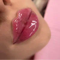 جشنواره مرکز تزریق چربی صورت ،ژل ،بوتاکس.prp|خدمات آرایشگری و زیبایی|کرج, اصفهانی‌ها|دیوار