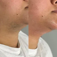 خانه لیزر صدراتضمینی|خدمات آرایشگری و زیبایی|صدرا-فارس, فاز ۱|دیوار