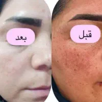 کرم گیاهی|آرایشی، بهداشتی، درمانی|بهار, |دیوار