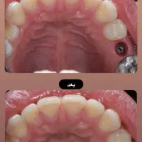 جشنواره خدمات دندانپزشکی سیب ( کلینیک دولتی)|خدمات زیبایی و سلامت|تبریز, |دیوار