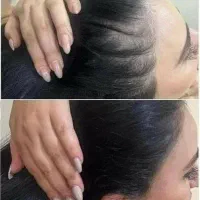 پذیرش مدل اسکالپ سر به صورت رایگان|خدمات آرایشگری و زیبایی|تهران, دروس|دیوار