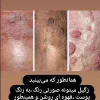 پاکسازی کامل پوست