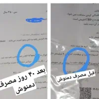 درمان تضمینی کبدجرب بامحصولات گیاهی شرکت کاژان|خوردنی و آشامیدنی|رباط‌کریم, شهرک صنعتی نصیرآباد|دیوار
