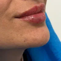 منشی مطب زیبایی