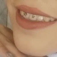 جشنواره خدمات ژل و بوتاکس و مزو ژل و آنزیم و....|خدمات آرایشگری و زیبایی|مشهد, نوید|دیوار