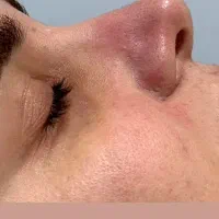 فشیال تخصصی با بهترین برند اکلدو|خدمات آرایشگری و زیبایی|برازجان, |دیوار