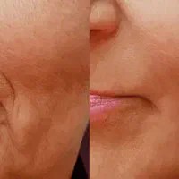 جوانسازی|آرایشی، بهداشتی، درمانی|شیراز, عفیف‌آباد|دیوار