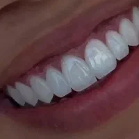 خدمات دندان‌پزشکی با تعرفه سال پیش