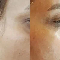 جشنواره پاکسازی پوست فقط سیصد تومان کپشن رو بخون|خدمات آرایشگری و زیبایی|مشکین‌دشت, |دیوار