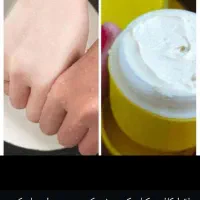 کرم سفید کننده ۳ روزه