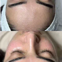 فیشال تخصصی و حرفه ای 50% تخفیف به مدت محدود|خدمات آرایشگری و زیبایی|شیراز, رحمتآباد|دیوار