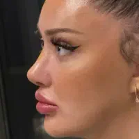 عمل بینی لیپوابدو لیفت غبغب دایرکت ابروتخفیف تهران|خدمات آرایشگری و زیبایی|قزوین, |دیوار