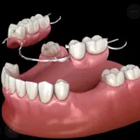 پروتز پارسیل ،دست دندون